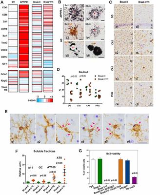 Microglia in Alzheimer’s Disease: Activated, Dysfunctional or Degenerative